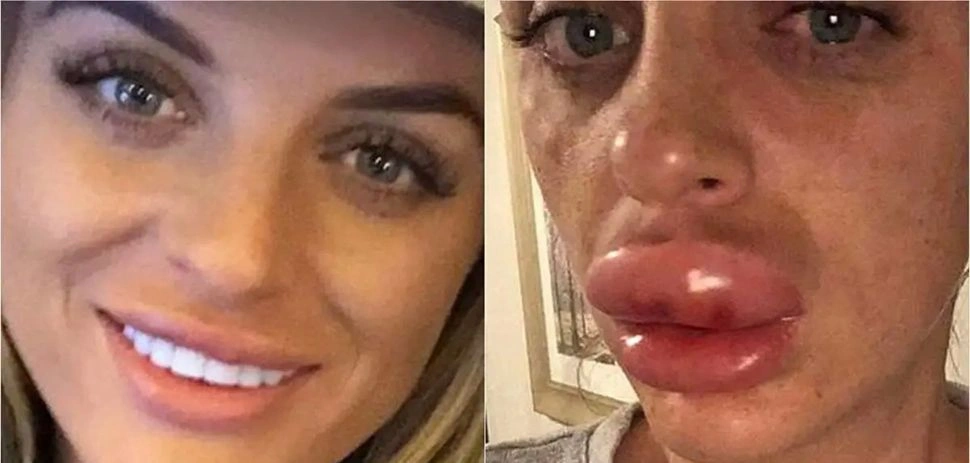 ,اجراءات تجميلية