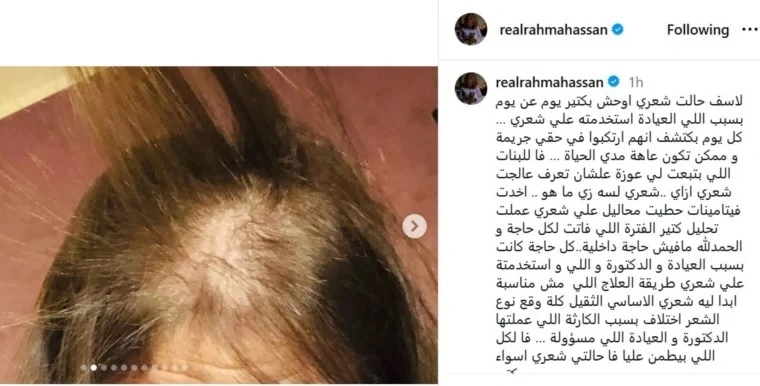 عاهة مستديمة عاهة مستديمة