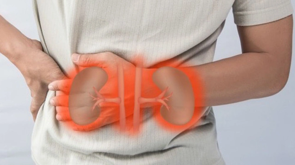 مرض , فشل كلوي , أطباء , صحة مرض , فشل كلوي , أطباء , صحة