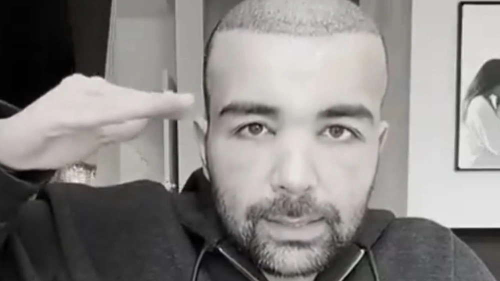 عقيل الرئيسي,الفنان عقيل الرئيسي, زراعة الشعر,انتفاخ الوجه