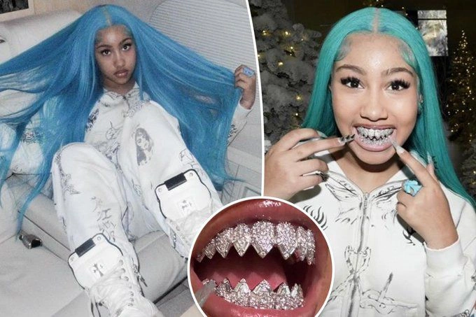 نورث ويست , &nbsp;كيم كارداشيان &nbsp;, كانييه ويست &nbsp;, &nbsp;إنستغرام , &nbsp;أطقم أسنان , جواهر