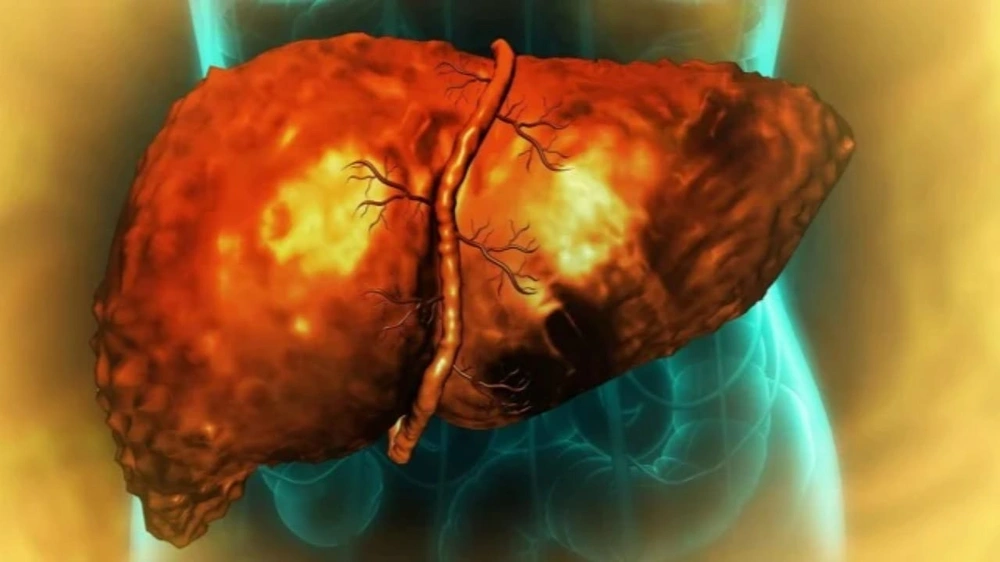 الإصابة بالأمراض, السرطان ,نظام عذائي, الدهون ,خلايا الكبد, تكسير الدهون, حالة بدائية, صحة عامة